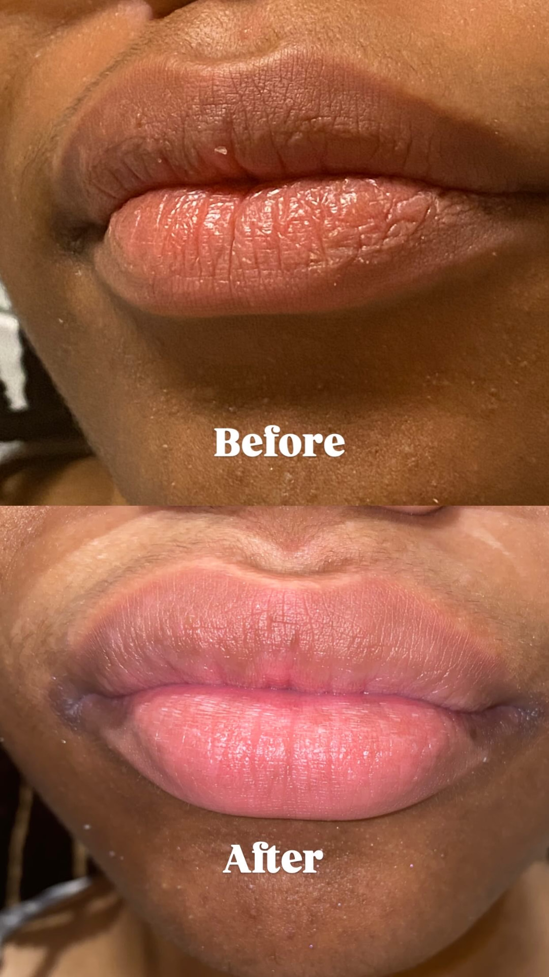 Before and after using PoutFrost Strawberry lip scrub